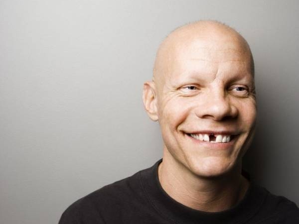 Implant sans douleur, avec le sourire !